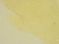 Thulinius saltursus image