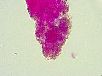 Thulinius saltursus image