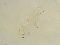 Thulinius saltursus image