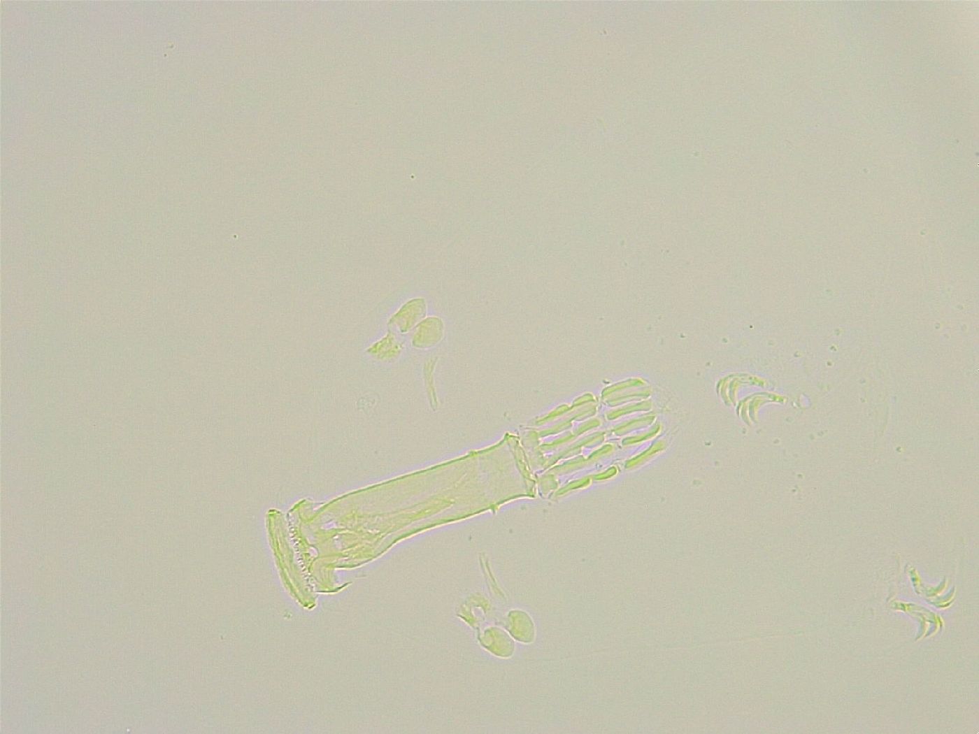 Paramacrobiotus areolatus image