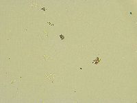 Paramacrobiotus areolatus image