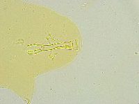 Paramacrobiotus areolatus image