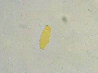 Paramacrobiotus areolatus image