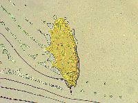 Paramacrobiotus areolatus image