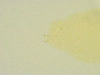 Paramacrobiotus areolatus image