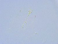 Paramacrobiotus areolatus image