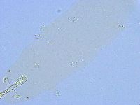 Paramacrobiotus areolatus image