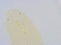 Paramacrobiotus areolatus image