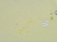 Paramacrobiotus areolatus image
