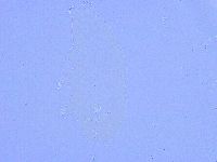 Paramacrobiotus areolatus image