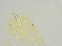 Paramacrobiotus areolatus image
