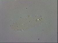 Paramacrobiotus areolatus image