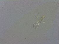 Paramacrobiotus areolatus image