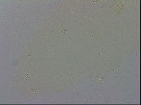 Paramacrobiotus areolatus image