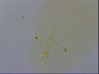 Paramacrobiotus areolatus image