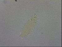 Paramacrobiotus areolatus image