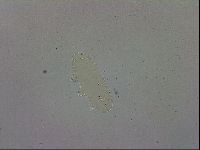 Paramacrobiotus areolatus image