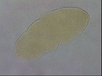 Paramacrobiotus areolatus image