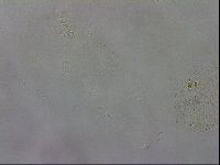 Paramacrobiotus areolatus image