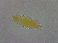 Paramacrobiotus areolatus image