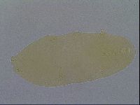Paramacrobiotus areolatus image