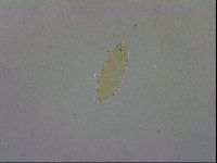 Paramacrobiotus areolatus image