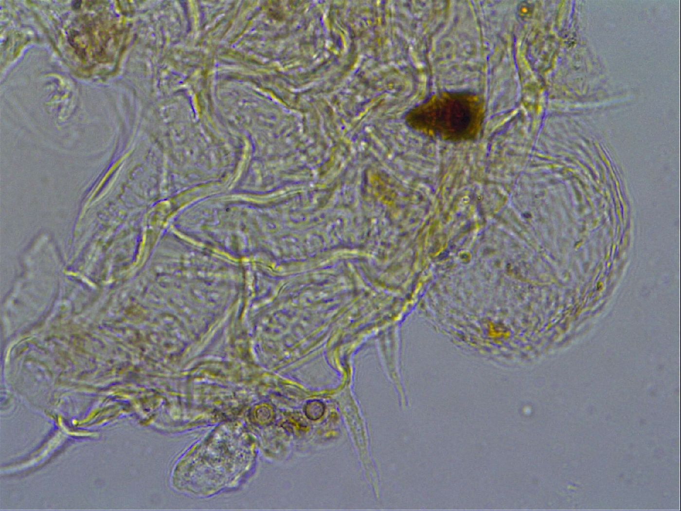 Macrobiotus psephus image