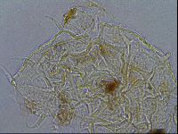 Media resource of Macrobiotus psephus
