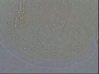 Macrobiotus psephus image