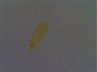 Paramacrobiotus areolatus image