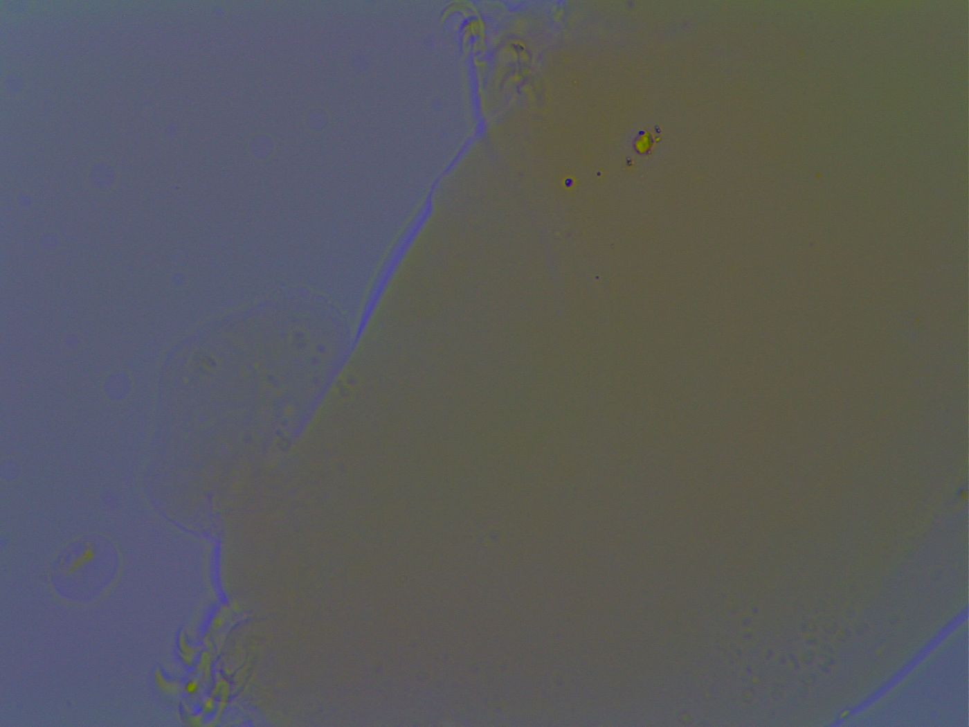 Paramacrobiotus areolatus image