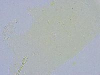 Dactylobiotus dispar image