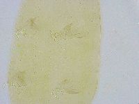 Dactylobiotus dispar image