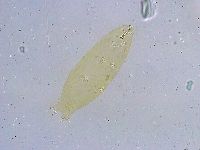 Dactylobiotus dispar image
