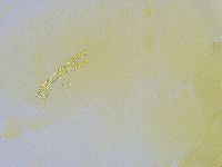 Dactylobiotus dispar image