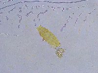 Dactylobiotus dispar image