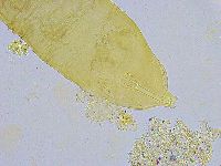 Dactylobiotus dispar image