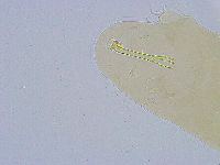 Dactylobiotus dispar image