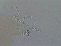 Adorybiotus granulatus image