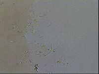 Adorybiotus granulatus image