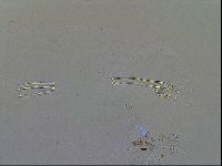 Adorybiotus granulatus image