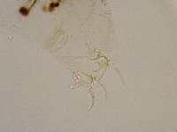 Adorybiotus granulatus image