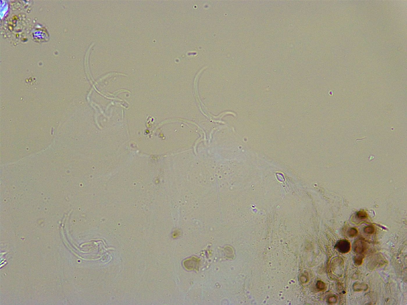 Adorybiotus granulatus image