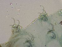 Adorybiotus granulatus image