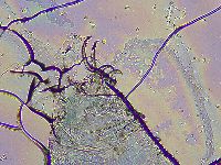 Adorybiotus granulatus image