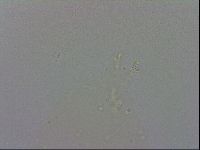 Mesobiotus coronatus image