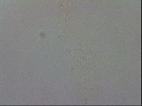 Mesobiotus coronatus image