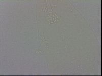 Mesobiotus coronatus image