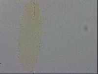 Mesobiotus coronatus image