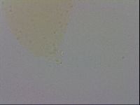 Mesobiotus coronatus image